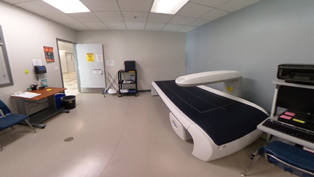 iDXA machine that measures body composition and bone mineral density